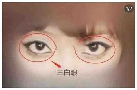 上三白意思|下三白眼真的不好嗎？分析男女三白眼面相：3大方法。